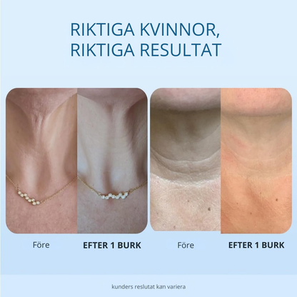 Dermavia Necklift - När du vill se skillnad